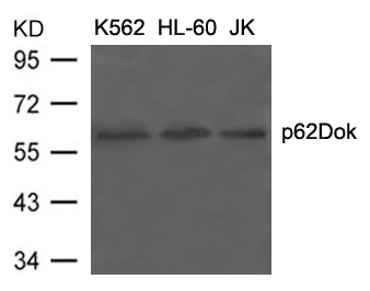 p62Dok (Ab-398) Antibody