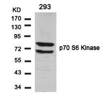 p70 S6 Kinase (Ab-424) Antibody