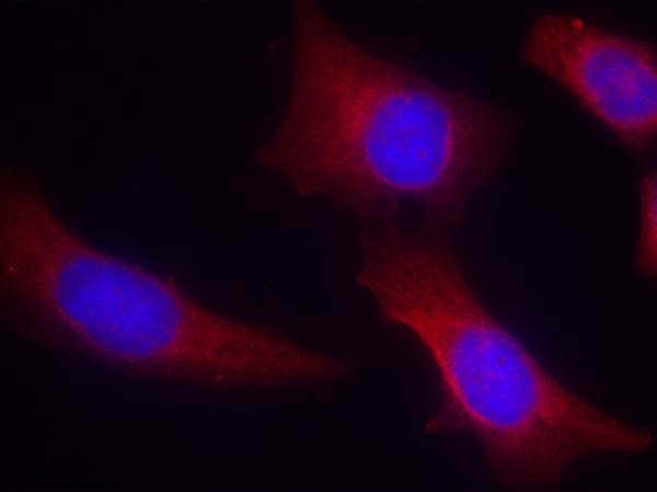 CaMKII (Ab-286) Antibody