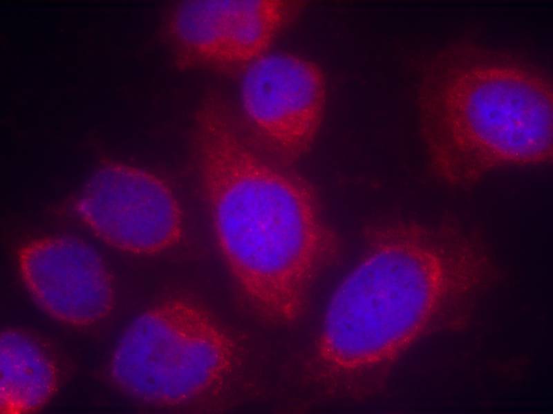 CPI17α (Ab-38) Antibody