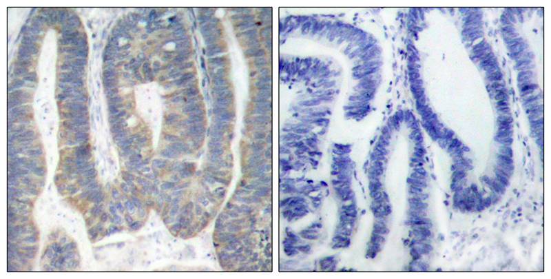 PKR (Ab-451) Antibody