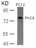 PKCδ (Ab-645) Antibody