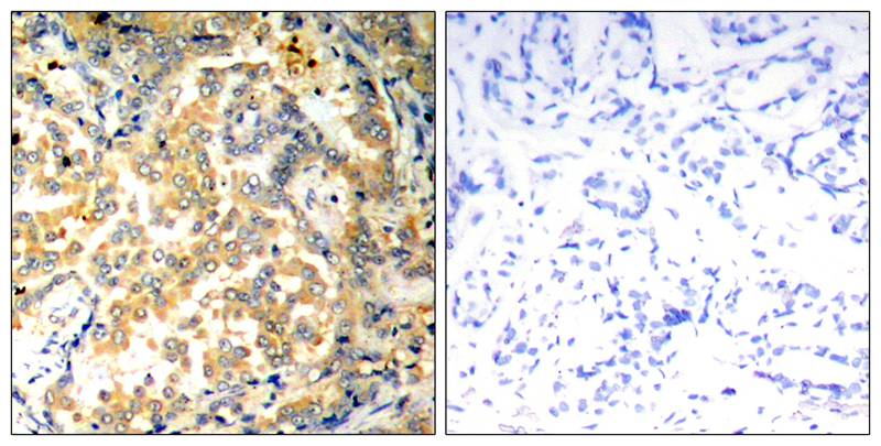 NFκB-p100/p52 (Ab-872) Antibody