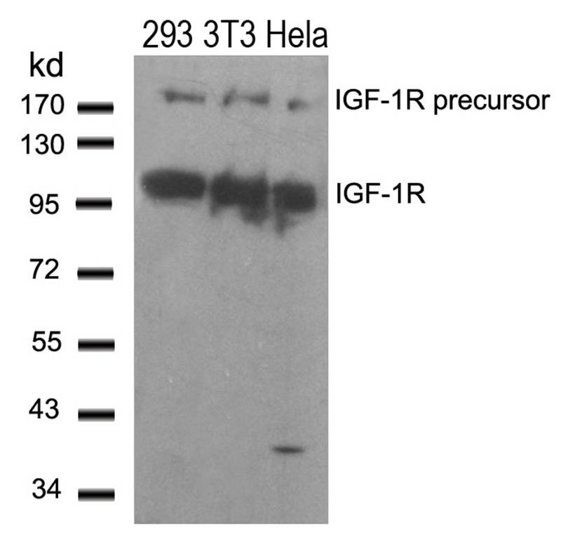 IGFR (Ab280) Antibody
