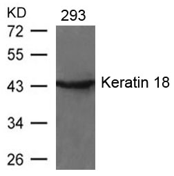 Keratin 18 (Ab-33) Antibody