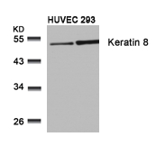 Keratin 8 (Ab-74) Antibody