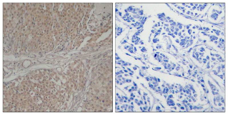 Smad3 (Ab-208) Antibody