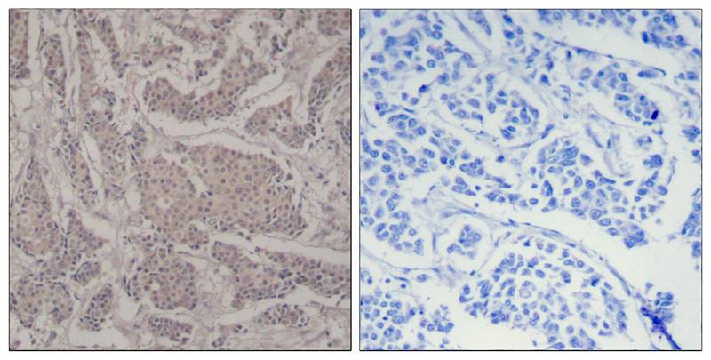 Smad3 (Ab-425) Antibody