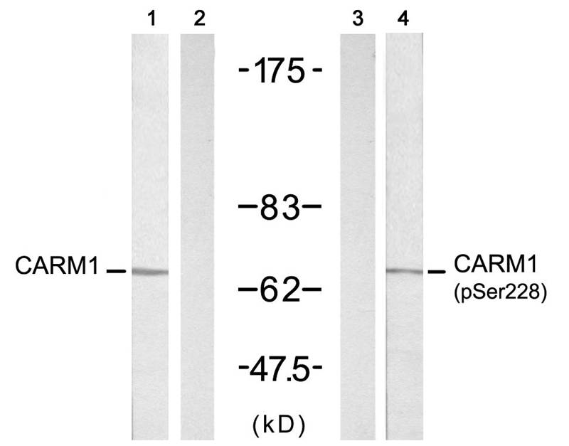 CARM1 (Ab-228) Antibody