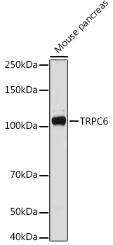 TRPC6 Antibody