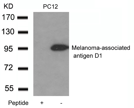 Melanoma-associated antigen D1 Antibody