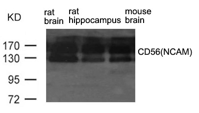 CD56(NCAM) Antibody