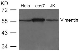 Vimentin Antibody