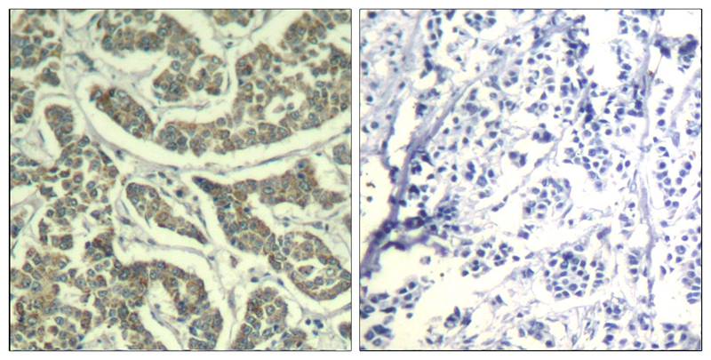 ATR (Ab-428) Antiobdy