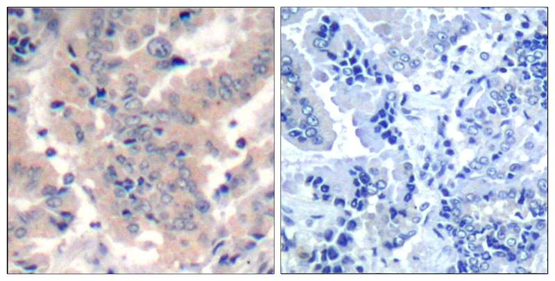 PI3 Kinase p85/p55(Ab-467/199) Antibody