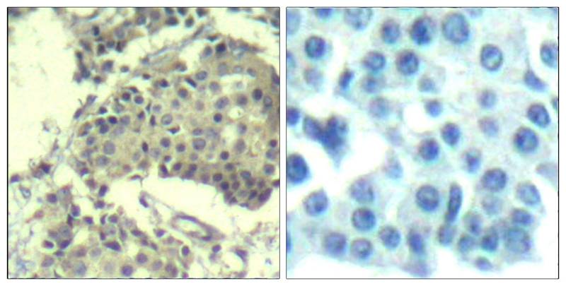 mTOR (Ab-2481) Antibody