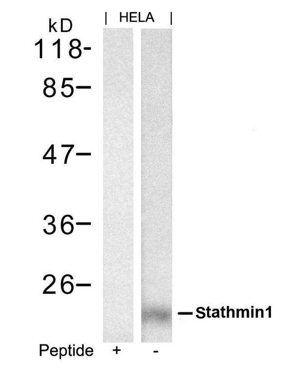 stathmin1 (Ab-62) Antibody