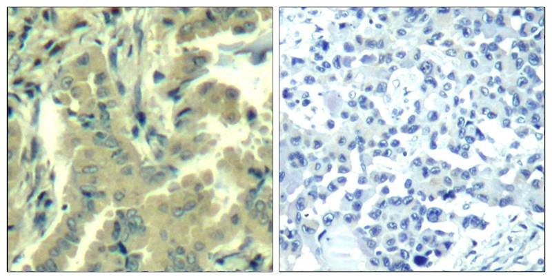 PLC-γ2 (Ab217) Antibody