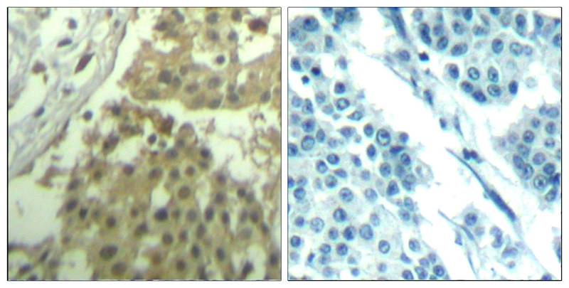 CDC2 (Ab9) Antibody