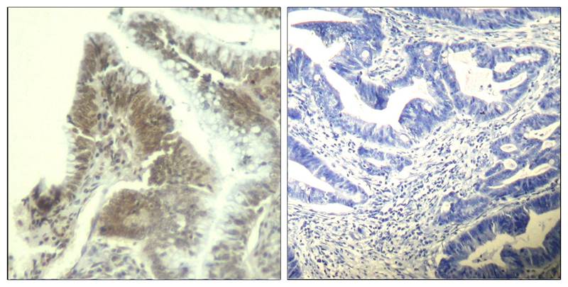CDK6 (Ab3) Antibody