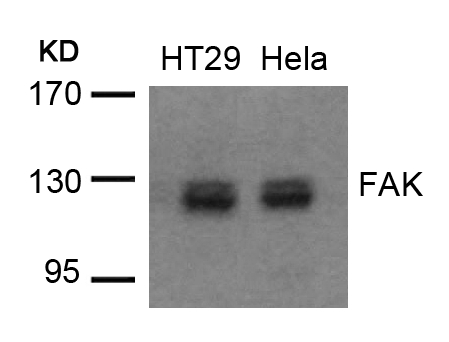 FAK (Ab-576/577) Antibody