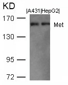 Met (Ab003) Antibody