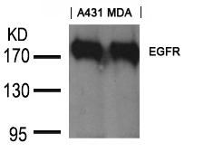 EGFR (Ab197) Goat Polyclonal Antibody