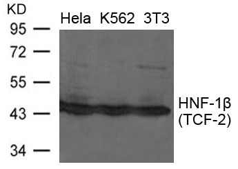 HNFβ(TCF-2) Antibody