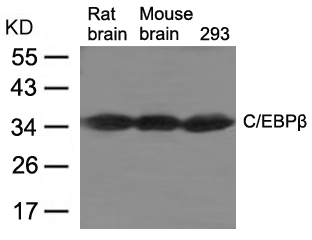 C/EBPβ Antibody