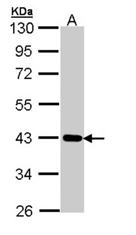Cartilage-associated protein antibody
