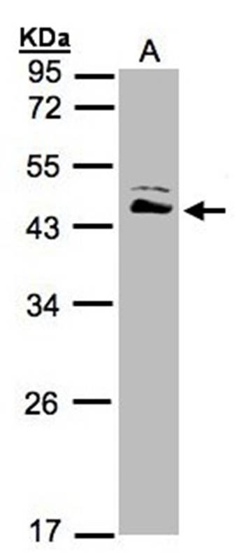 ASS1 antibody
