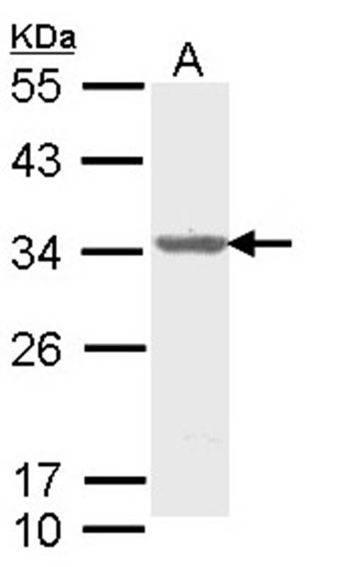 ALY antibody