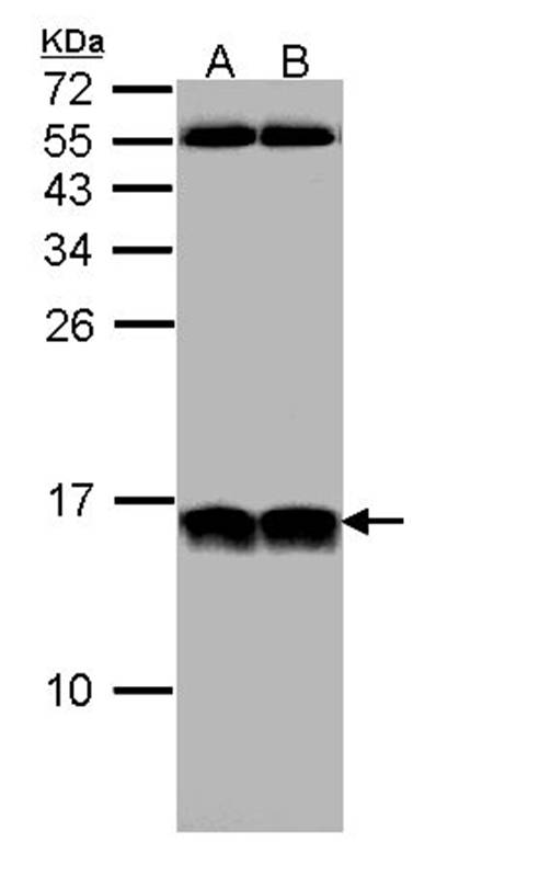 NHP2-like protein 1 antibody