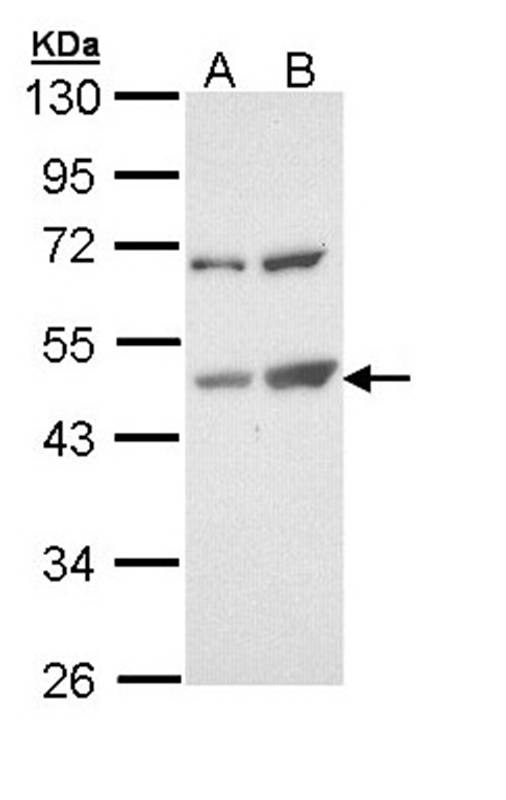 TSPYL1 antibody