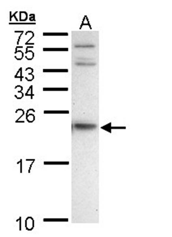 APRT antibody