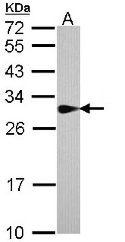 SPR antibody