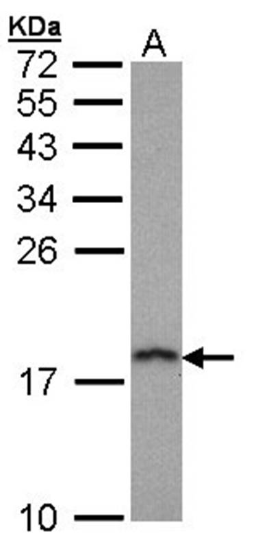 prefoldin 5 antibody
