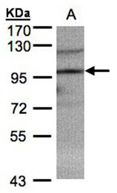 TRIM37 antibody