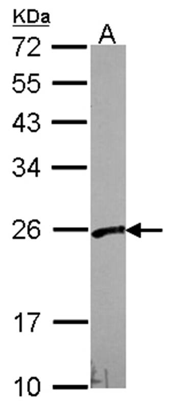 VBP1 antibody