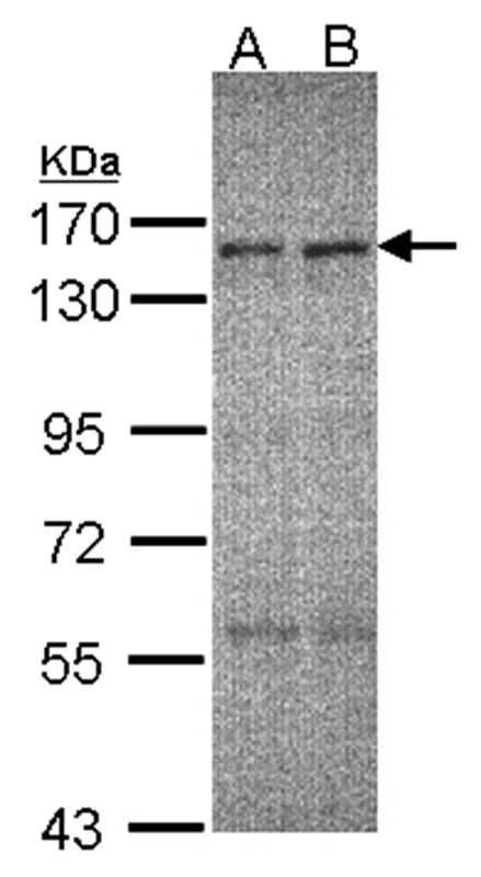 ERCC6 antibody