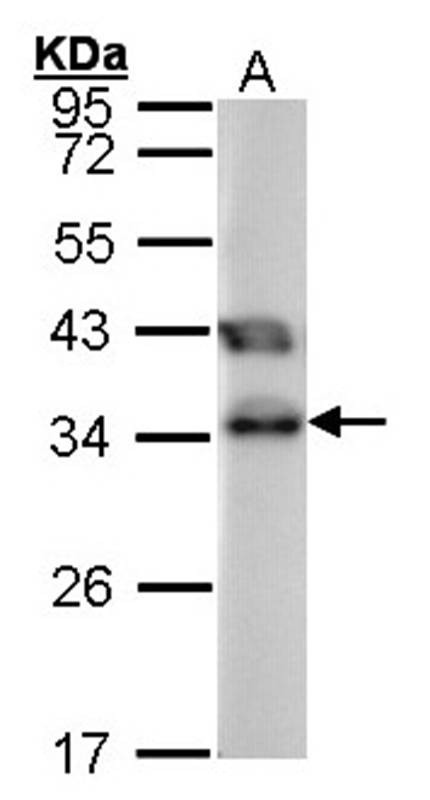 TTC1 antibody