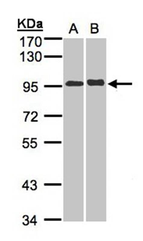 IL2 Receptor beta2 antibody