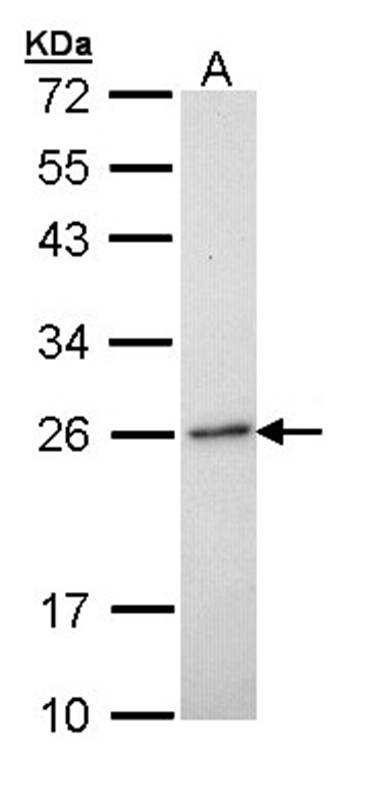 RAB6A antibody