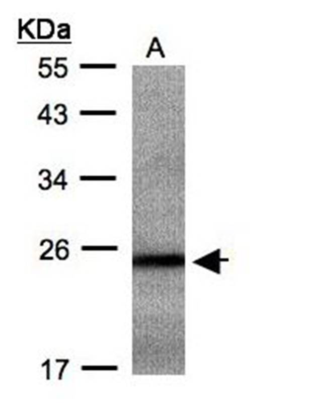 RAB2B antibody