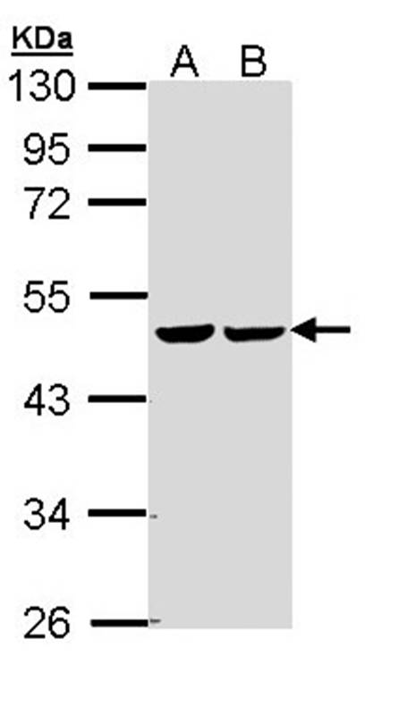 fumarate hydratase antibody