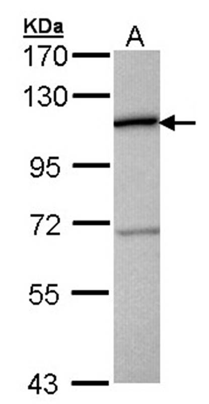 CTBP2 antibody