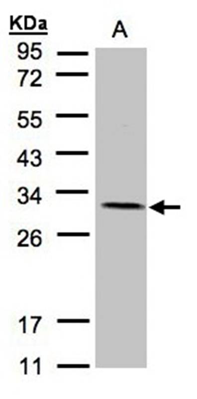 NDUFV2 antibody