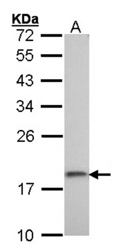 ribosomal protein S10 antibody