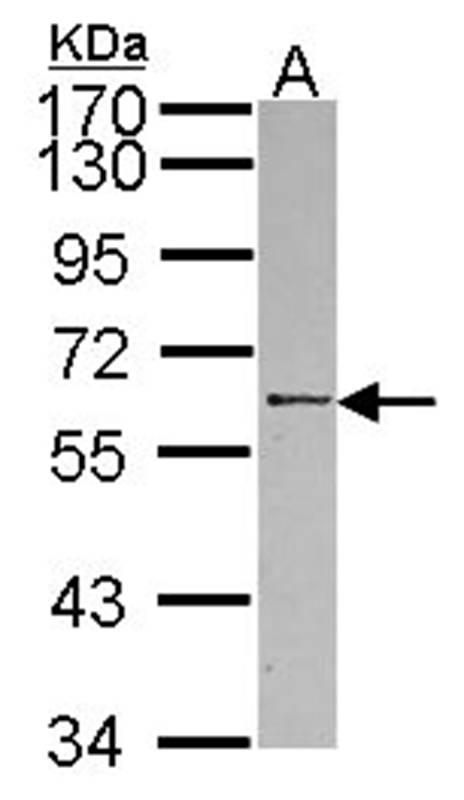 RBMY1A1 antibody