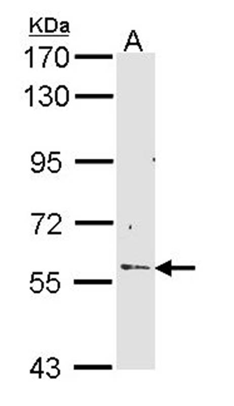 RCBTB2 antibody